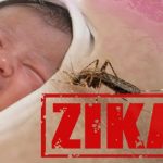 Zika a concern, can cause birth defects anytime during pregnancy